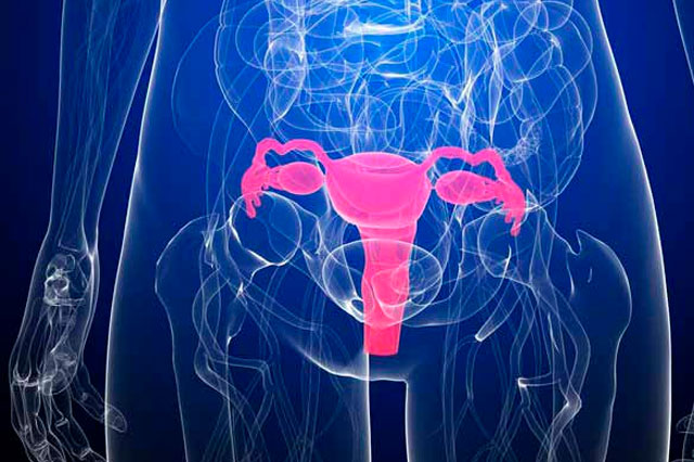 Dr Paulo Ramalho - Miomatose Uterina